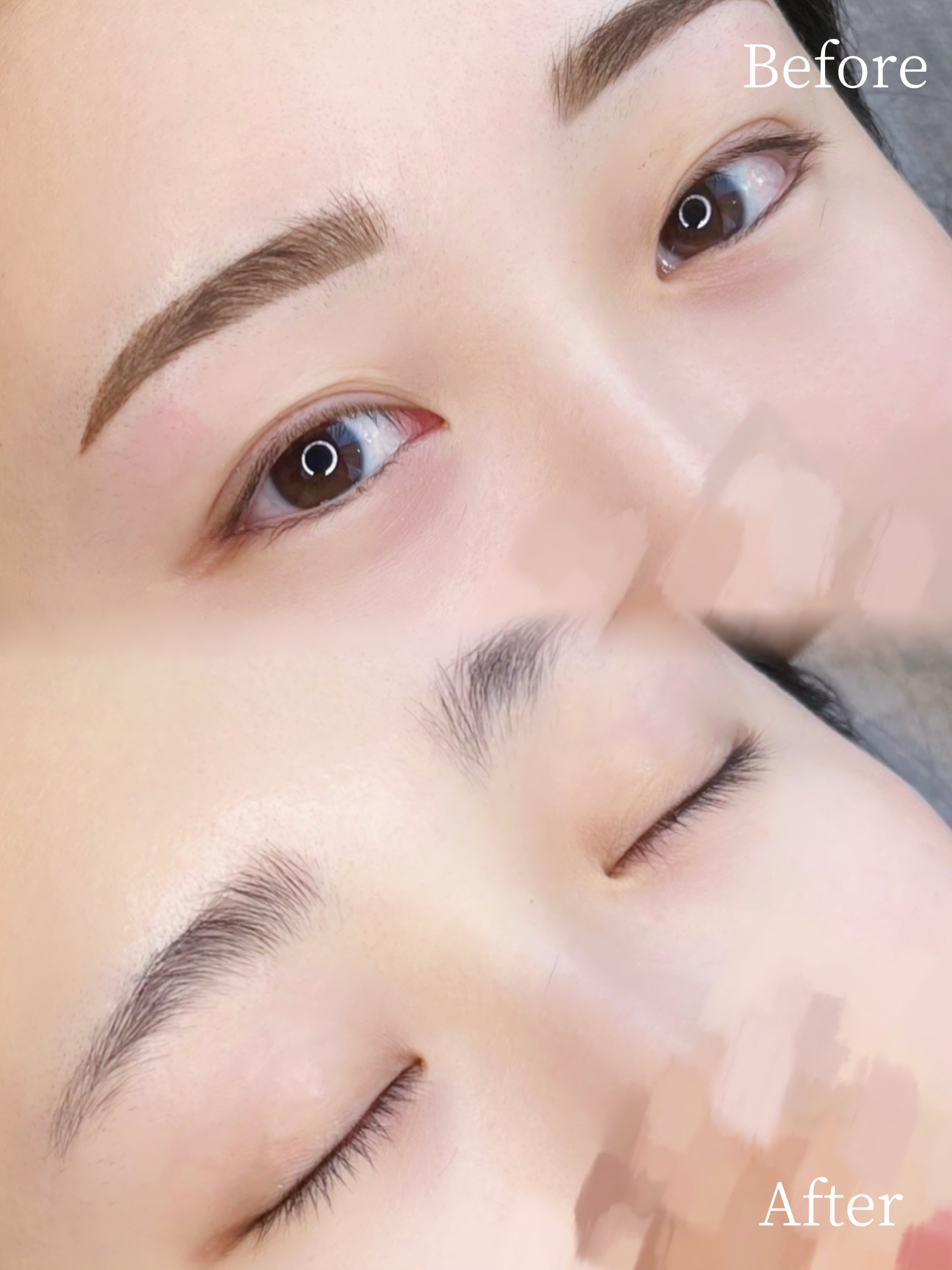 リーズプライベートクリニック｜眉アートメイクの症例